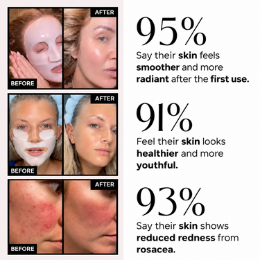 Koko Bio-Collagen Mask