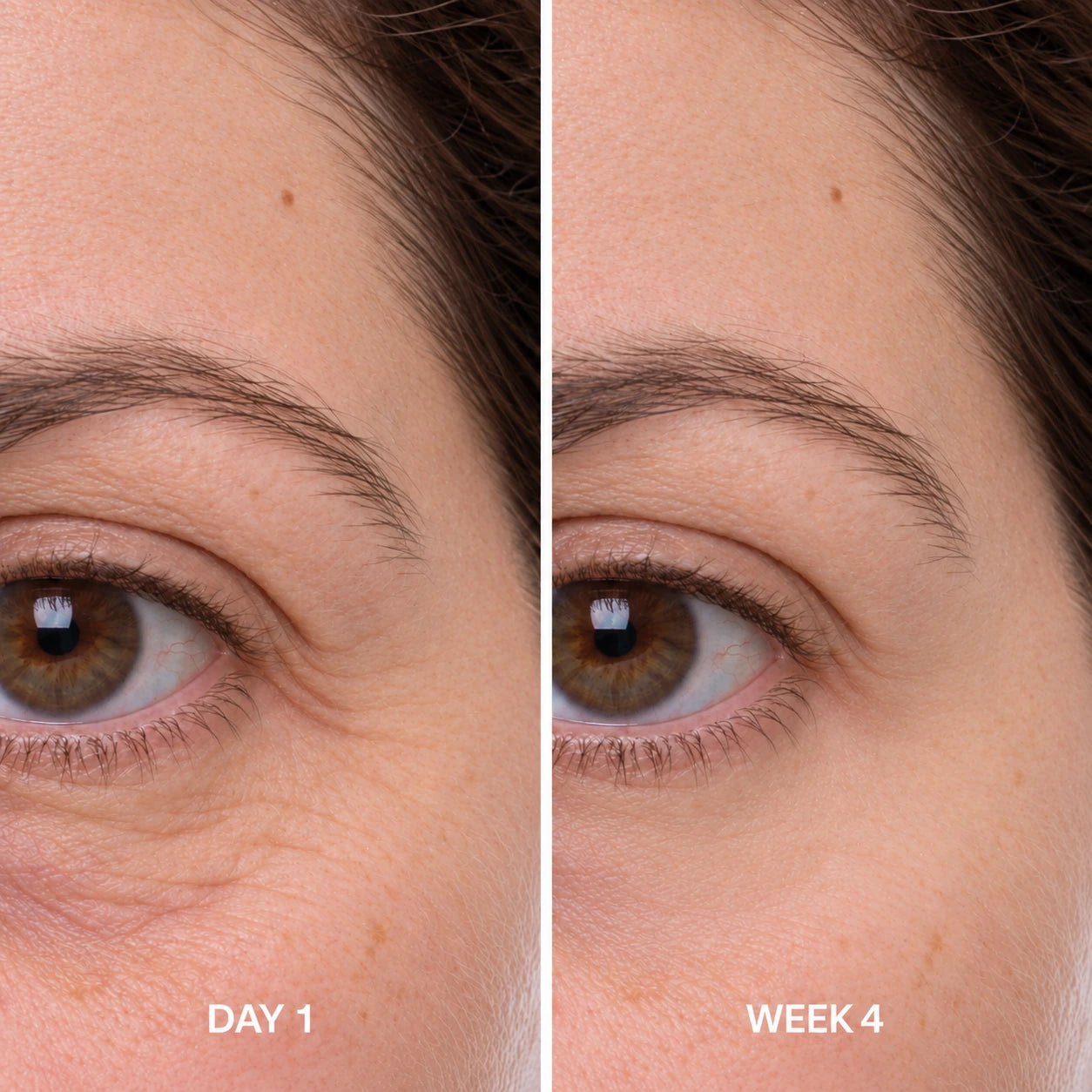 Eye-area comparison labelled Day 1 on the left and Week 4 on the right